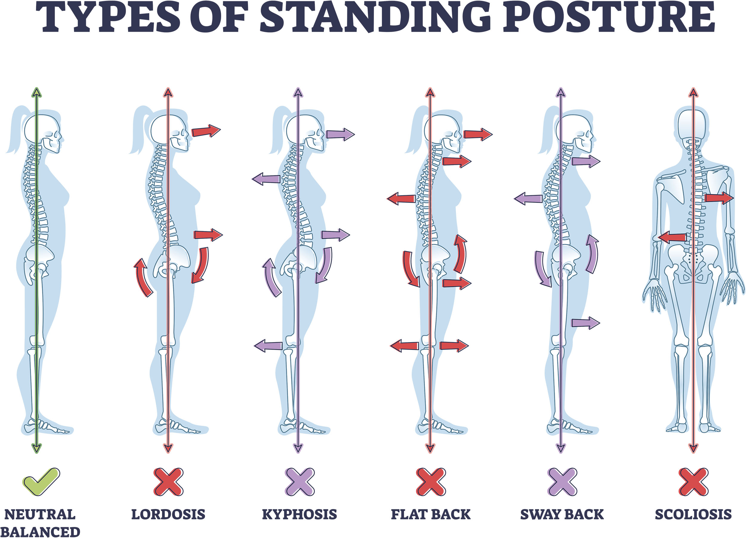 Przykłady garbienia się 
