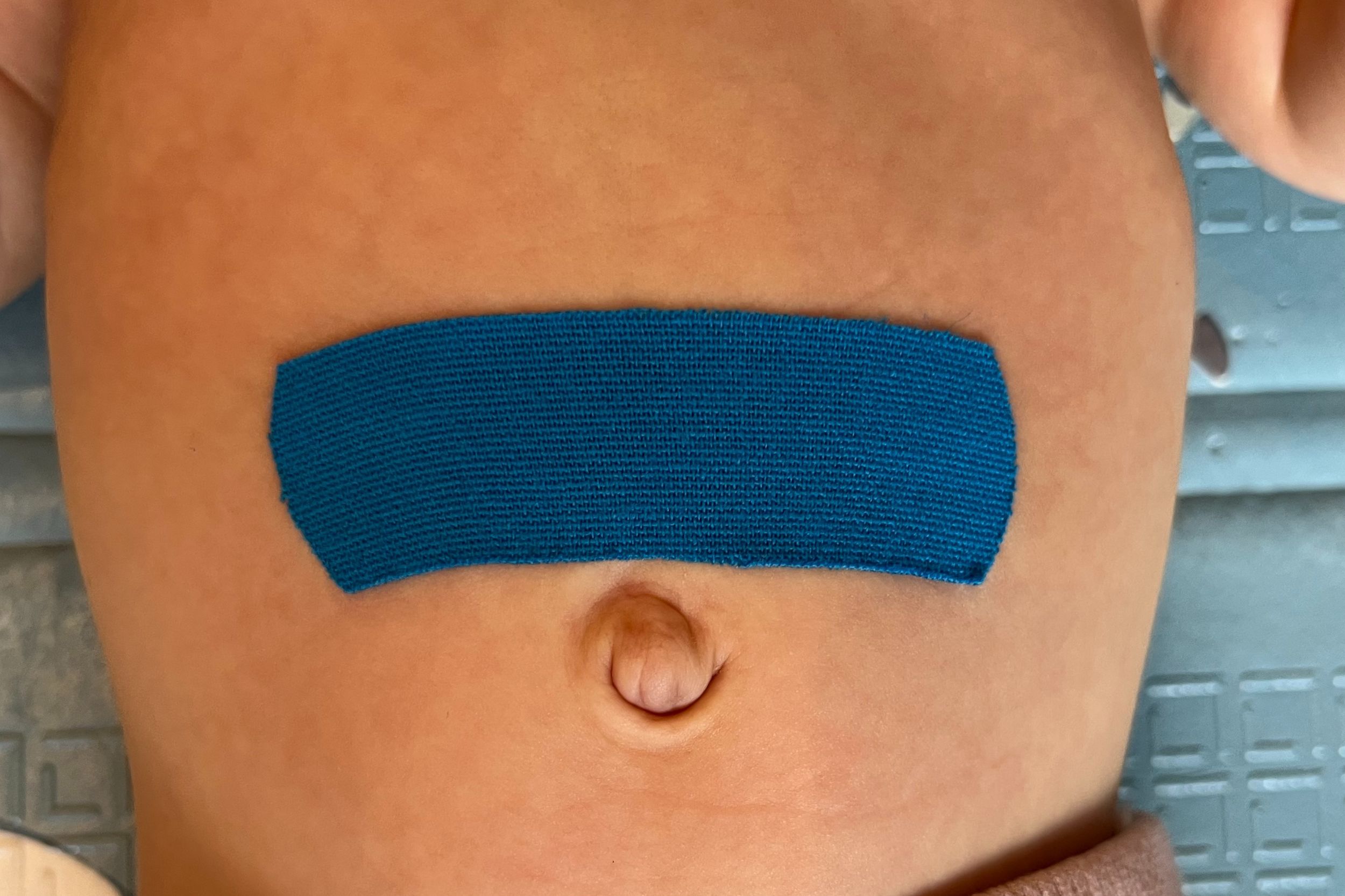 Przykładowa aplikacja kinesiotapingu u dzieci Jak stosować kinesiotaping u dzieci?