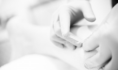 Suche igłowanie - metoda leczenia bólu mięśniowo-powięziowego  