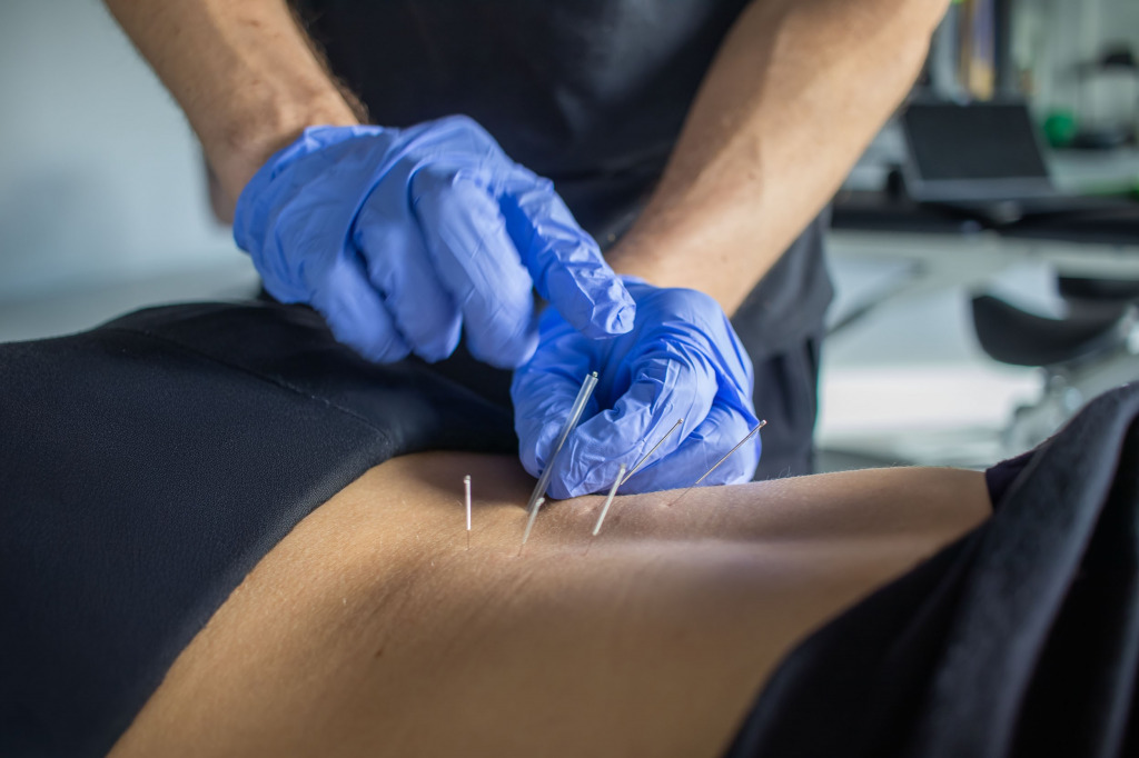 Suche igłowanie - właściwości i zastosowania 