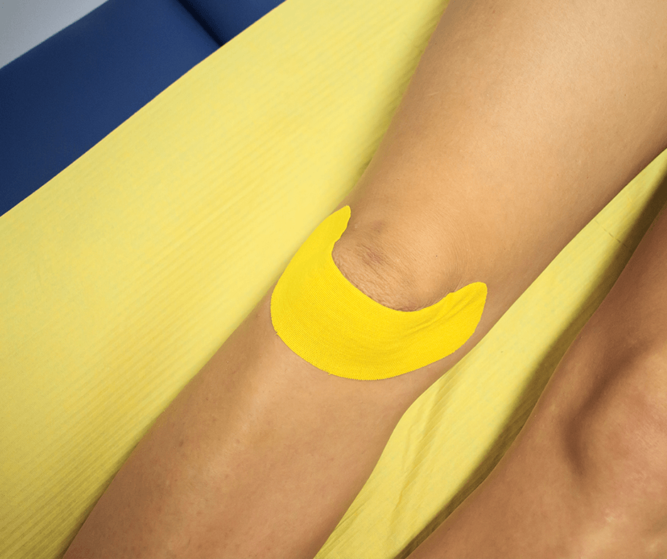 Kinesiotaping - Stabilizacja rzepki